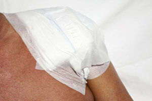 Bandage after the shoulder operation, please see also my other images of surgery and ambulances