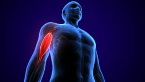3D illustration showing an individual with biceps tendinopathy.