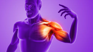 Anatomical Animation of Painful Shoulder Muscle and Joint Caused by Torn Rotator Cuff