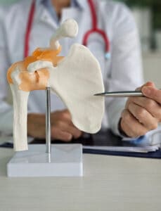 Medical professional demonstrates shoulder anatomy using a model during a rotator cuff repair consultation